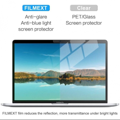FILMEXT MacBook Pro Anti Mavi Ik Filtreli Koruyucu (16 in)(2021)