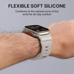 Bandletic Apple Watch 11 Uyumlu Manyetik Silikon Kay��-Starlight