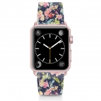 Casetify Apple Watch Kay (42mm)-Keepsake