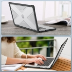 Fintie MacBook Pro Koruyucu Sert Kapakl Klf (14 in)-Crystal Clear