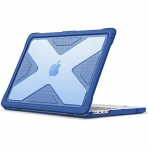 Fintie MacBook Pro Koruyucu Sert Kapakl Klf (14 in)-Blue