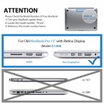 LENTION Retina MacBook Pro Tam Ekran Koruyucu (15 in�)