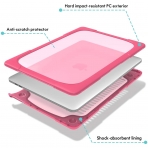 ProCase MacBook Pro Standl Koruyucu Klf (13 in)(M1)-Rose