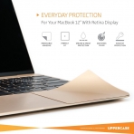 UPPERCASE MacBook Palm Rest Koruyucu (12 in-Gold)