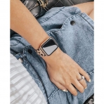 amBand Apple Watch Deri Kayış (38/40mm)-Cheetah Dots