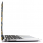 iDoo Apple MacBook Air Fruit Serisi Klf (13 in)-Banana