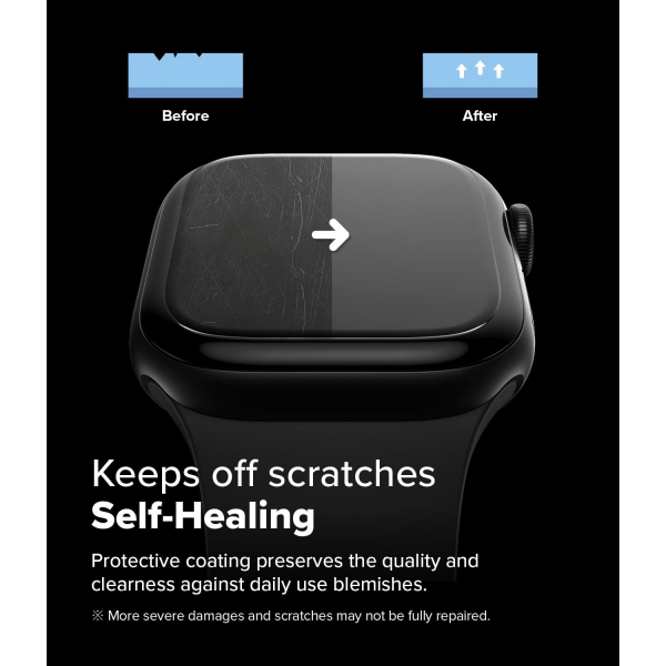 Rin gke Apple Watch 10 46mm Easy Pro Ekran Koruyucu 