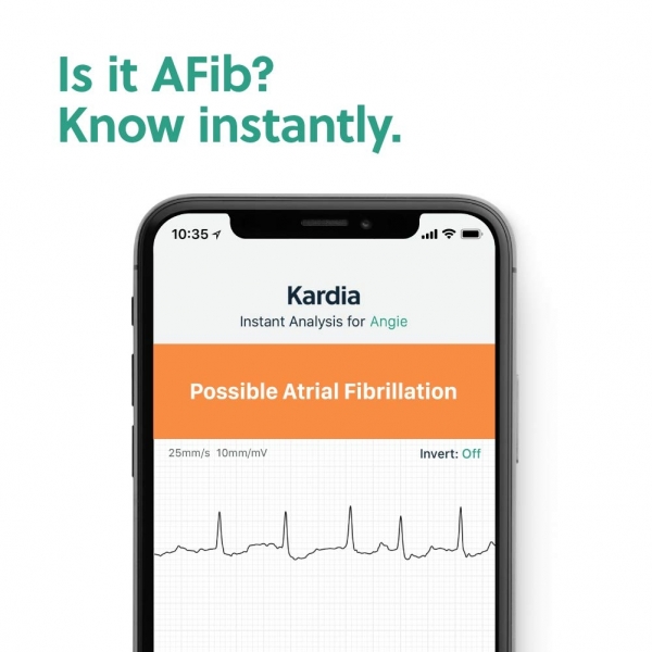 AliveCor KardiaMobile 6L Akll Mini EKG Kardiyo Cihaz