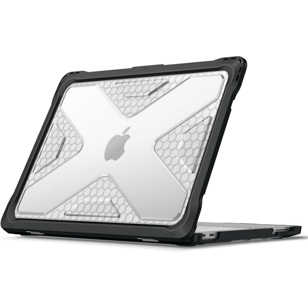 Fintie Tuatara MacBook Neo Laptop K�l�f�-Clear