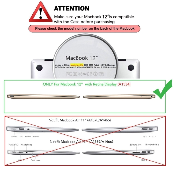 Mosiso Retina Ekranl Macbook 12 in Hard Klf-Gold